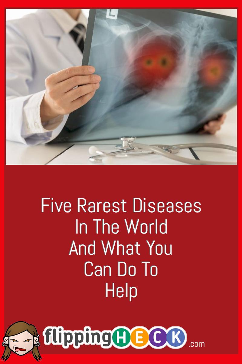 Five Rarest Diseases In The World And What You Can Do To Help